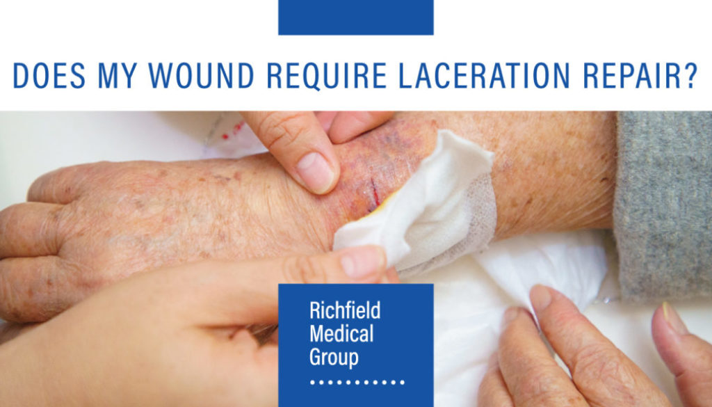 Hands dressing a wound - text that reads: Does My Wound Require Laceration Repair?