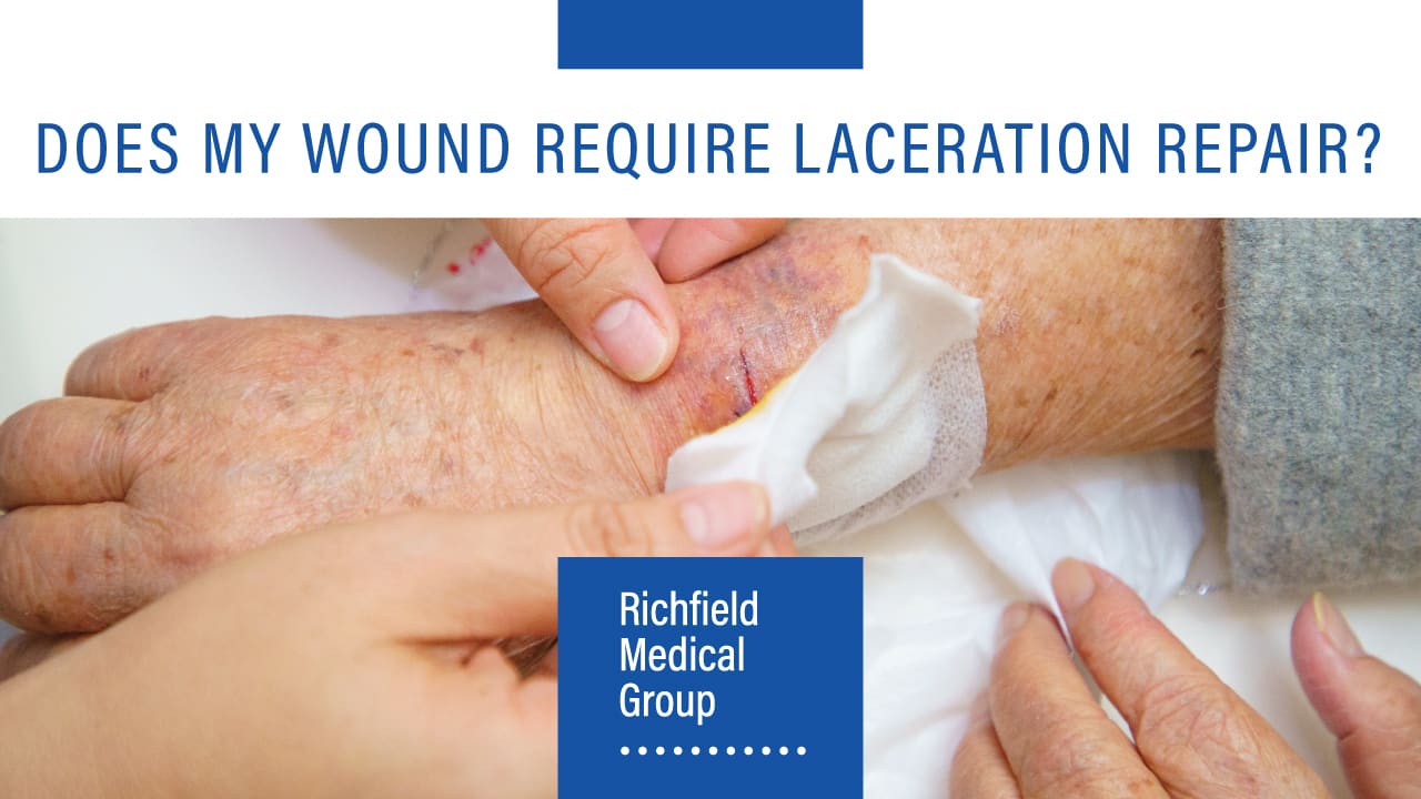 Hands dressing a wound - text that reads: Does My Wound Require Laceration Repair?